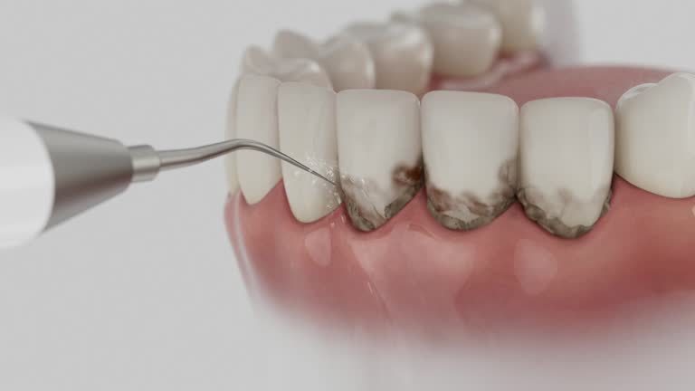 Trusted Teeth Cleaning And Checkup service in Radford, VA - Dentist Open Now